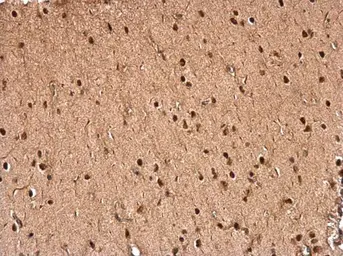 Anti-CPSF6 antibody used in IHC (Paraffin sections) (IHC-P). GTX115537