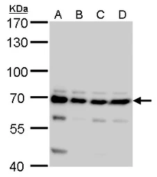 Anti-CPSF6 antibody used in Western Blot (WB). GTX115537
