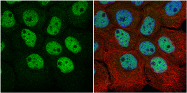 Anti-RbAp48 antibody [N1C2] used in Immunocytochemistry/ Immunofluorescence (ICC/IF). GTX115554