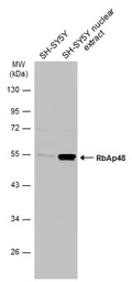Anti-RbAp48 antibody [N1C2] used in Western Blot (WB). GTX115554