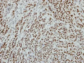 Anti-RbAp48 antibody [N1C2] used in IHC (Paraffin sections) (IHC-P). GTX115554