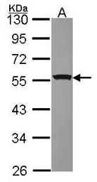 Anti-RbAp48 antibody [N1C2] used in Western Blot (WB). GTX115554