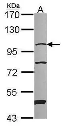 Anti-NARG1 antibody used in Western Blot (WB). GTX115560