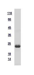 Human DUSP14 protein, His tag. GTX115563-pro