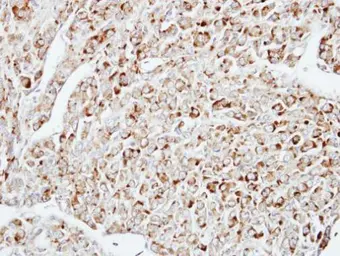 Anti-DUSP10 antibody [N1C1] used in IHC (Paraffin sections) (IHC-P). GTX115564