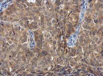 Anti-FGFR1OP antibody [N1C2] used in IHC (Paraffin sections) (IHC-P). GTX115580