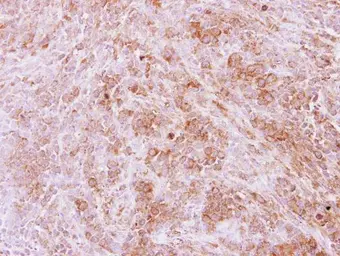 Anti-Calpain 11 antibody used in IHC (Paraffin sections) (IHC-P). GTX115584