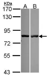 Anti-Calpain 11 antibody used in Western Blot (WB). GTX115584