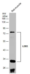 Anti-LDB3 antibody used in Western Blot (WB). GTX115593