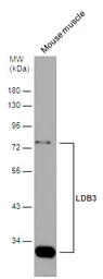Anti-LDB3 antibody used in Western Blot (WB). GTX115593