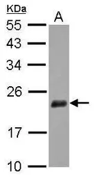 Anti-NUDT3 antibody used in Western Blot (WB). GTX115595