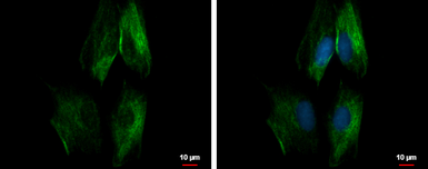 Anti-SEC23IP antibody used in Immunocytochemistry/ Immunofluorescence (ICC/IF). GTX115597