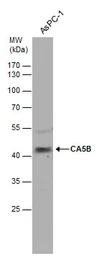 Anti-CA5B antibody used in Western Blot (WB). GTX115604