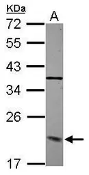 Anti-DCTN3 antibody used in Western Blot (WB). GTX115607
