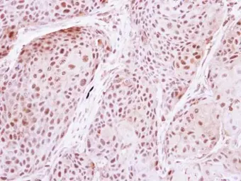 Anti-DDX19B antibody [C1C3] used in IHC (Paraffin sections) (IHC-P). GTX115611