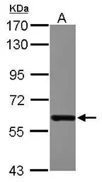 Anti-DDX19B antibody [C1C3] used in Western Blot (WB). GTX115611