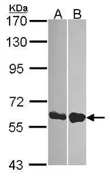 Anti-DDX19B antibody [N1N3] used in Western Blot (WB). GTX115612