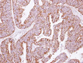 Anti-KLHL2 antibody used in IHC (Paraffin sections) (IHC-P). GTX115614
