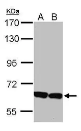 Anti-KLHL2 antibody used in Western Blot (WB). GTX115614
