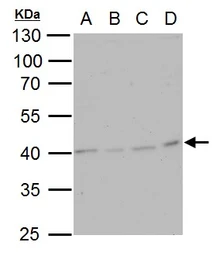 Anti-TWF2 antibody used in Western Blot (WB). GTX115626