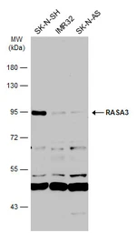 Anti-RASA3 antibody [C2C3], C-term used in Western Blot (WB). GTX115632