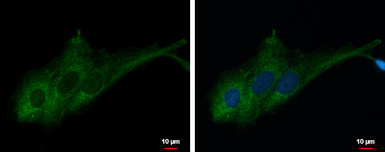 Anti-RASA3 antibody [C2C3], C-term used in Immunocytochemistry/ Immunofluorescence (ICC/IF). GTX115632