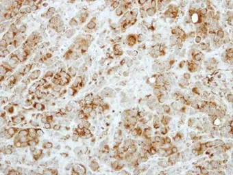 Anti-RASA3 antibody [C2C3], C-term used in IHC (Paraffin sections) (IHC-P). GTX115632