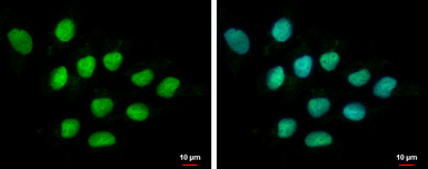 Anti-DIS3 antibody used in Immunocytochemistry/ Immunofluorescence (ICC/IF). GTX115645