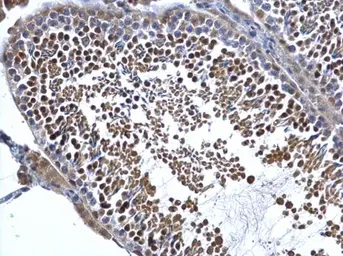 Anti-DIS3 antibody used in IHC (Paraffin sections) (IHC-P). GTX115645