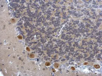 Anti-DIS3 antibody used in IHC (Paraffin sections) (IHC-P). GTX115645