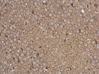 Anti-Rabphilin 3A antibody used in IHC (Paraffin sections) (IHC-P). GTX115646