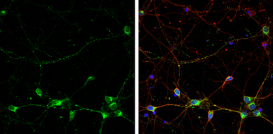 Anti-Rabphilin 3A antibody used in Immunocytochemistry/ Immunofluorescence (ICC/IF). GTX115646