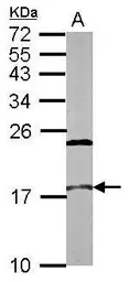 Anti-NCBP2 antibody [N1C3] used in Western Blot (WB). GTX115648