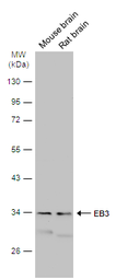 Anti-EB3 antibody used in Western Blot (WB). GTX115652