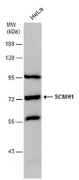Anti-SCMH1 antibody used in Western Blot (WB). GTX115653