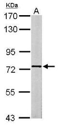 Anti-SCMH1 antibody used in Western Blot (WB). GTX115653