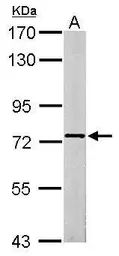 Anti-SCMH1 antibody used in Western Blot (WB). GTX115653