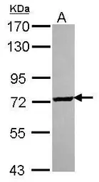 Anti-SCMH1 antibody used in Western Blot (WB). GTX115653