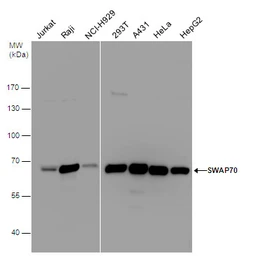Anti-SWAP70 antibody used in Western Blot (WB). GTX115667
