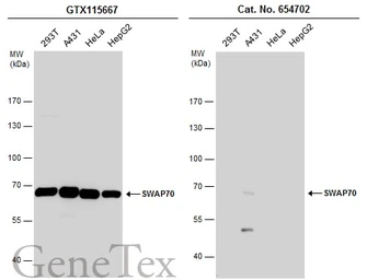 Anti-SWAP70 antibody used in Western Blot (WB). GTX115667