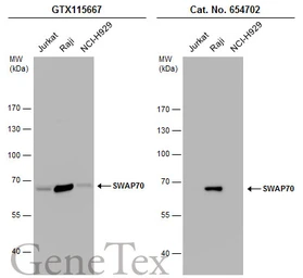Anti-SWAP70 antibody used in Western Blot (WB). GTX115667