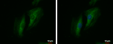 Anti-SWAP70 antibody used in Immunocytochemistry/ Immunofluorescence (ICC/IF). GTX115667