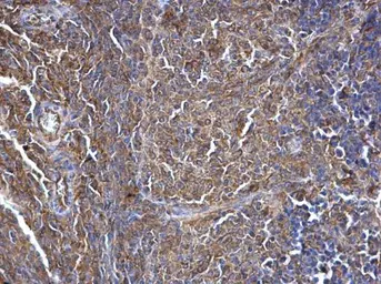 Anti-SWAP70 antibody used in IHC (Paraffin sections) (IHC-P). GTX115667