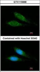 Anti-MRPS27 antibody used in Immunocytochemistry/ Immunofluorescence (ICC/IF). GTX115668