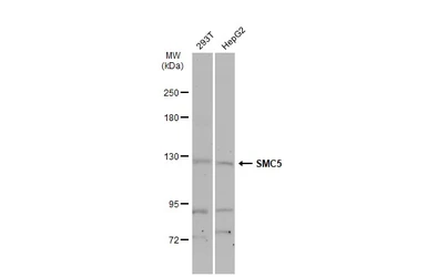 Anti-SMC5 antibody [N2N3] used in Western Blot (WB). GTX115669