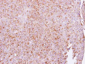 Anti-ETEA antibody [N3C3] used in IHC (Paraffin sections) (IHC-P). GTX115680