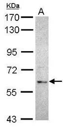 Anti-MGRN1 antibody [N1C1] used in Western Blot (WB). GTX115690
