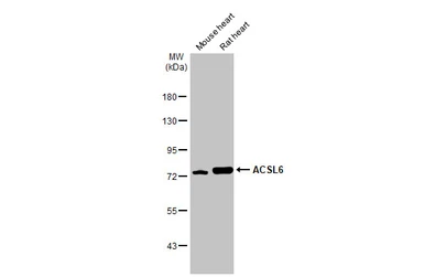Anti-ACSL6 antibody used in Western Blot (WB). GTX115693
