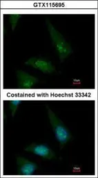 Anti-CLASP1 antibody used in Immunocytochemistry/ Immunofluorescence (ICC/IF). GTX115695