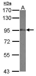 Anti-BRRN1 antibody [N1N2], N-term used in Western Blot (WB). GTX115699